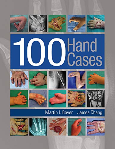 100 Hand Cases: With online access